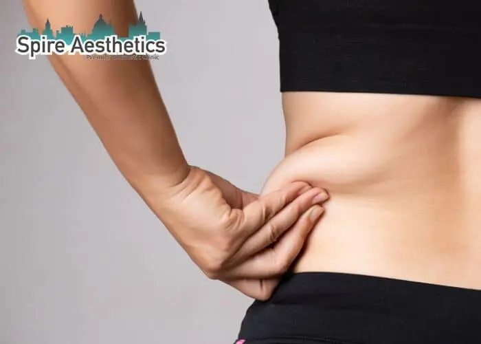 Image of woman pinching fat on their hips Walsall. Fat Freezing treatment