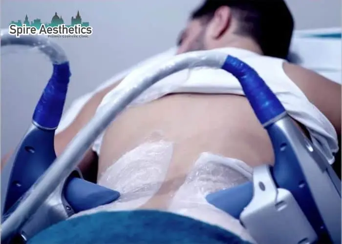 Man having fat freezing treatment done on love handles before a competitions Walsall to create a sculpted look.