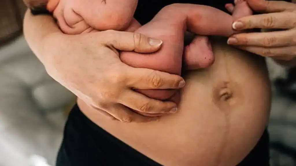 Why Is My Stomach Still Big After Pregnancy Walsall?