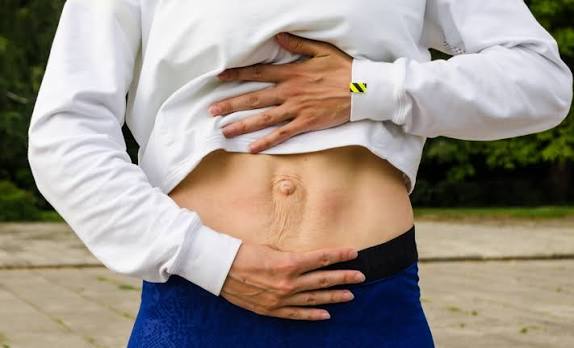 When Could Diastasis Recti Be the Missing Piece of the Puzzle Walsall?